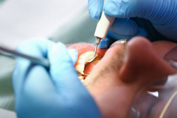 Tooth Infection Emergency Dentist in VA